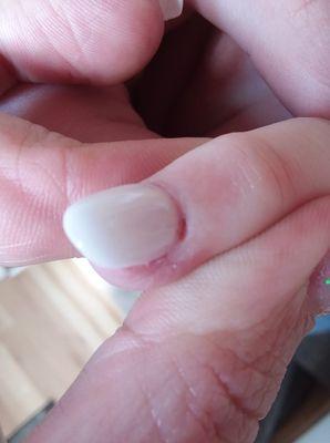 another cuticle cut!