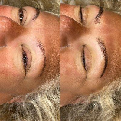 COMBINATION BROW TECHNIQUE