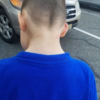 3 cuts on my kid's neck.