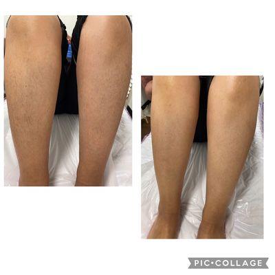 Before & After lower leg wax