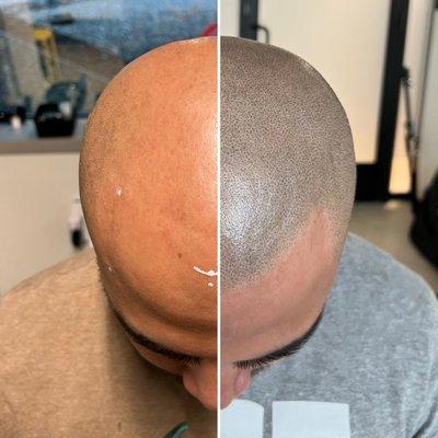 Scalp micropigmentation for men's hair loss. Before and after treatments by Edge Scalp Ink in Bethesda, Maryland.