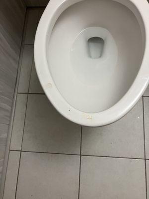 Filthy toilet that wasn't cleaned prior to either patient coming in or within 36 hours of check in