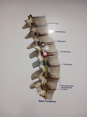 Different spine problems