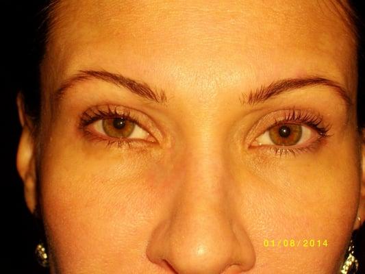 After 6 treatments.  Client also had a Lash Perm!