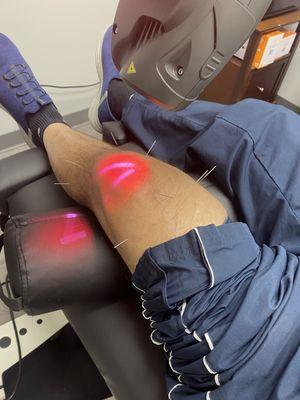 acupuncture and laser treatment