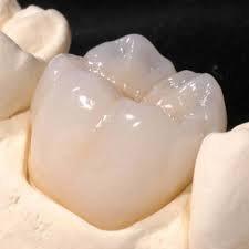 zirconia crown