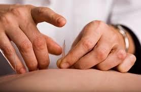 Acupuncture helps with pain relief, reduce stress, relieve allergy symptoms and IVF