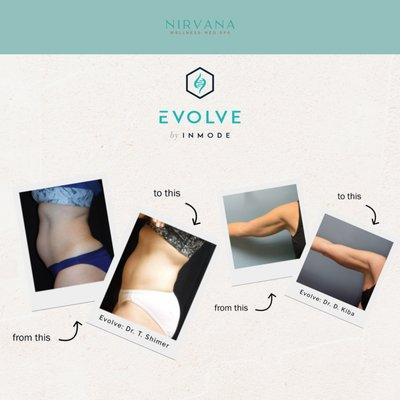 EvolveX Non-Invasive Body Contouring - Before & After