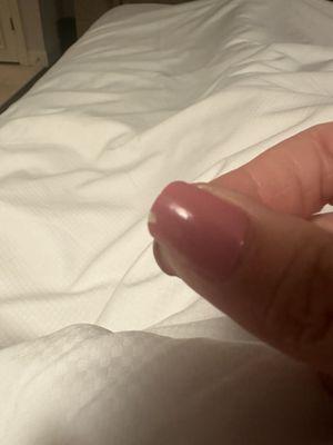 Chipped nail