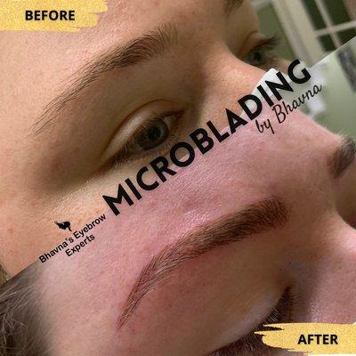 Microblading