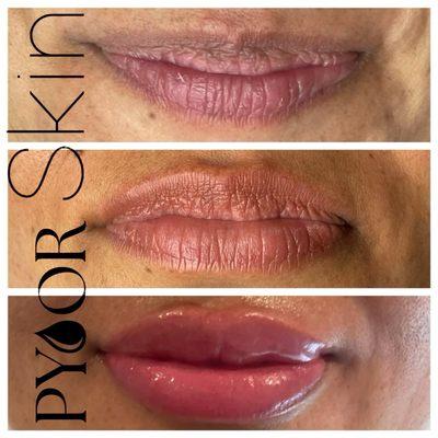 Lip Neutralize and Blush! These lips speak for themselves.