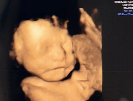 4D picture of my baby