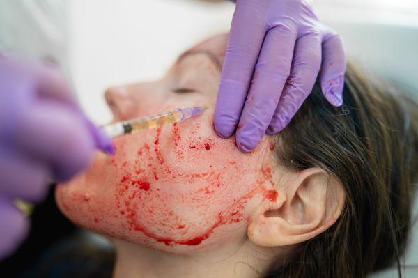 Platelet-Rich Plasma  -Facials -Hair Restoration