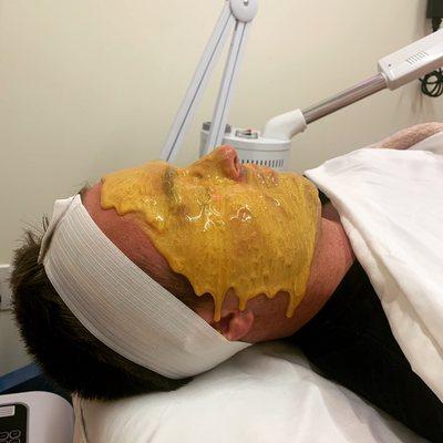 Gold Hydrojelly mask