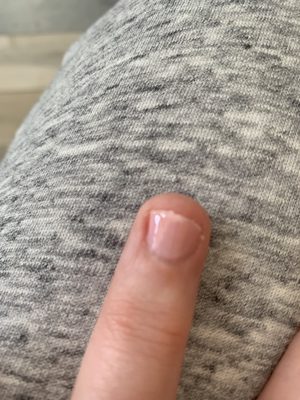 I told her my nail was splitting so this is how it ended up, still with a split, no glue, just filed so short.