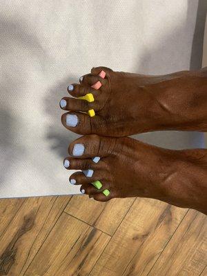 Medical Wellness Pedicure after podiatrist applied KerryFles