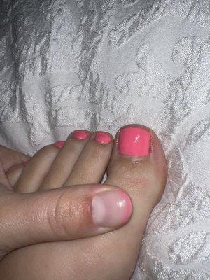 Uneven paint and red nail beds