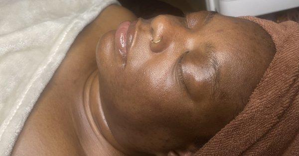 Glow Girl Facial with Microdermabrasion and Enzyme Treatment