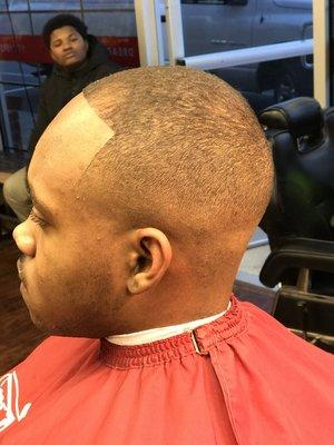 Bald fade