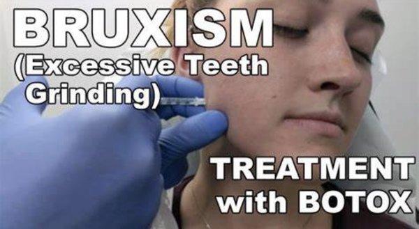 Tox injections can relax your masseter muscle and relieve your jaw clenching.