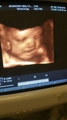 3D 4D Ultrasounds in our office!