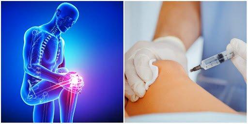 Biopuncture Injection Therapy Natural Pain relief with Homeopathic injection solution