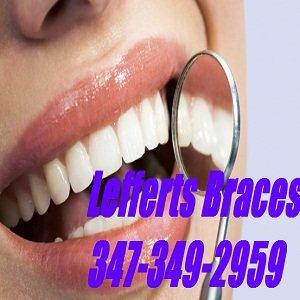 Lefferts Braces