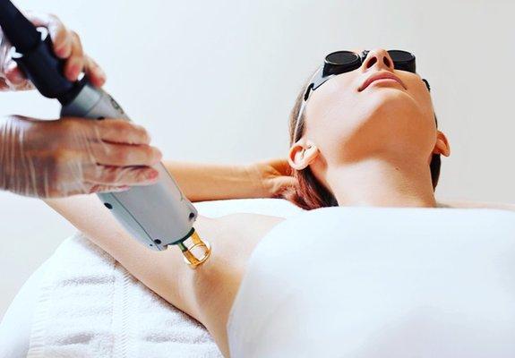 Laser Hair Removal