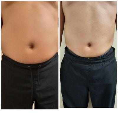 Flawless by Inathe Lipo Laser Spa