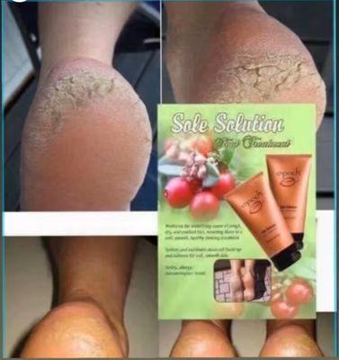 Solution for extremely dry skin.