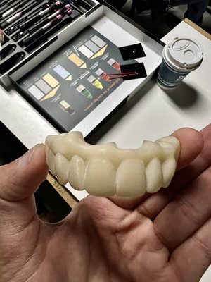 In house 3D printed teeth