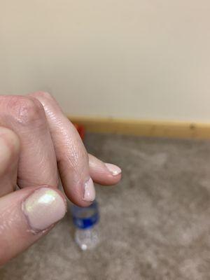 Note where the polish meets the cuticle and the bald patch