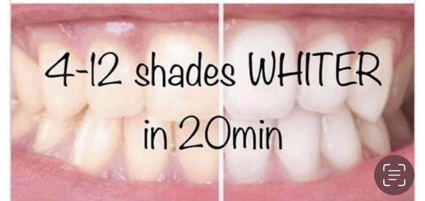 4-12 shades Whiter in 20 min