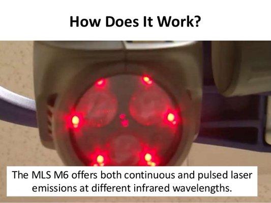 The MLS Robotic laser is actually multiple lasers at once. This increases the effectiveness.