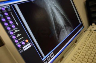 Radiography is a valuable diagnostic tool in veterinary medicine. As we continually strive to offer the highest quality medic...