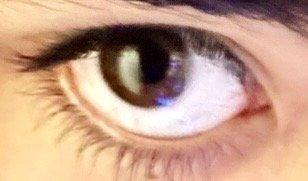 The whites of my eye now are now vibrant and healthy, they look like those of a cute baby!