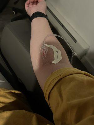 IV Hydration Treatment