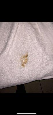 More Feces found on the towel.