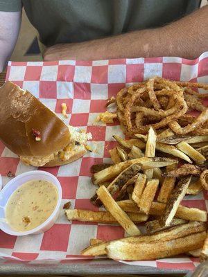 Onion strings and fries.