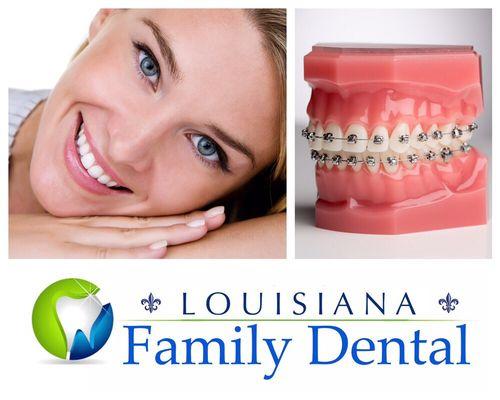 Braces can help straighten your teeth. Ask about our BACK TO SCHOOL SPECIAL! Get the smile you always wanted.