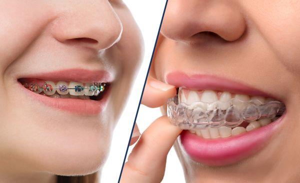 Interested in having a better smile? Wondering about having braces? Call us today for a Free consultation with our orthodontist 323-728-0241