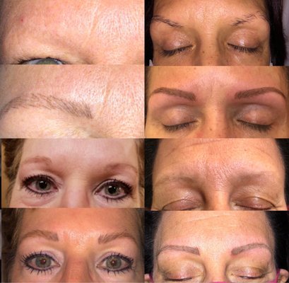 Microblading with machine