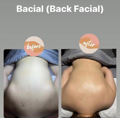 Back Facials