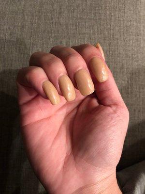 Crooked lumpy nails.