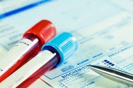 Diagnostic blood tests available, order your own