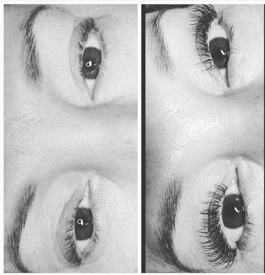 Before & after eyelash extensions