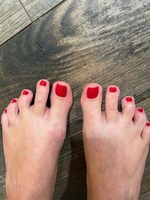 Toes uneven, polish was done sloppy and look at the cuticles.