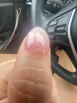 Worst nail experience