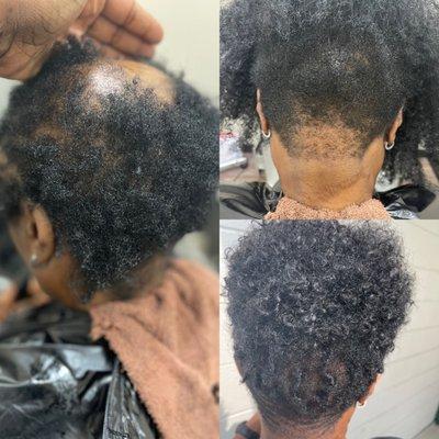 Before & After: Natural Textured Non-Surgical Hair Replacement Unit