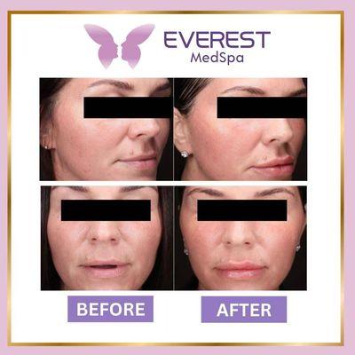 Everest Medspa